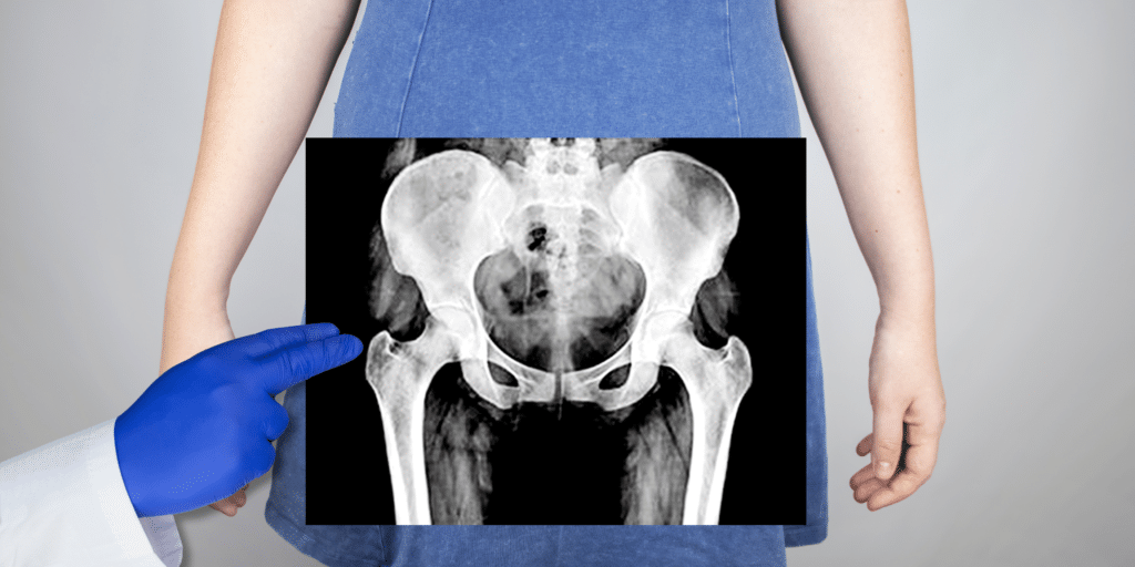 what is the pelvis pelvic floor pelvis pelvic bone